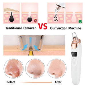 Blackhead Remover Exfoliating Beauty Device